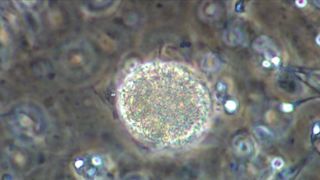 Katarzyna Warnke, Marieta Zukowska, Olga Boladz - Botoks (2017) sexy topless scenes